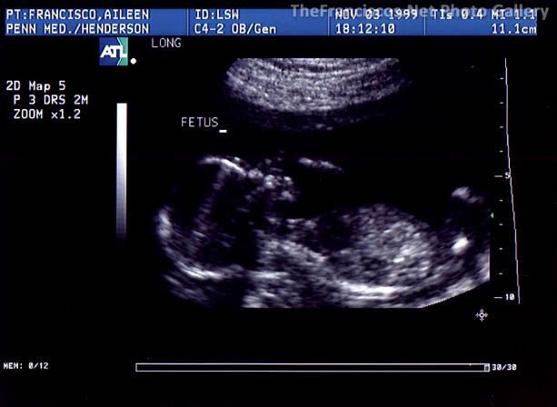 ultrasound02.jpg