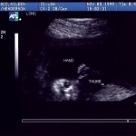 ultrasound01.jpg